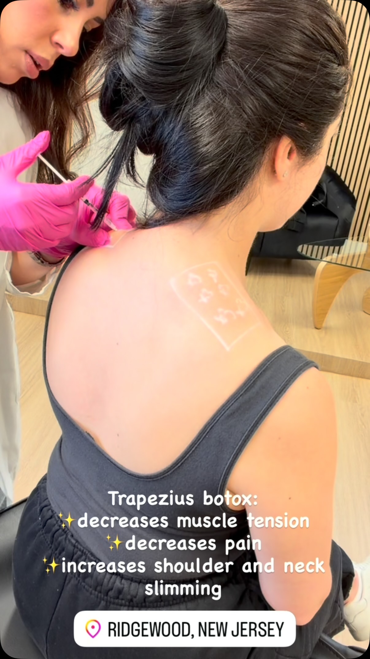 Trapezius Botox treatment at Aesthetics by Nada